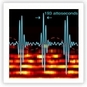 Attosecond and Ultrafast Physics IV